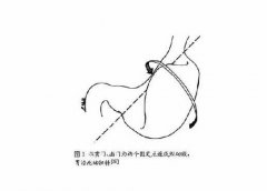 宠物狗喝水还能喝死了，你敢信？